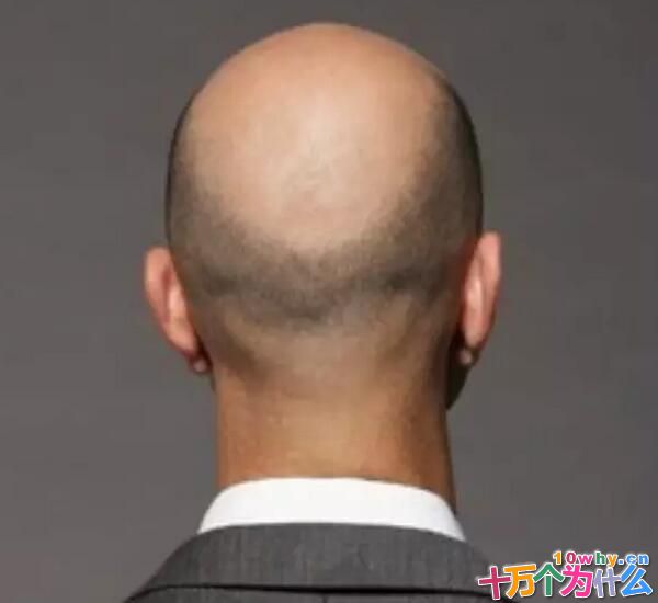 为什么男性比女性更容易秃头