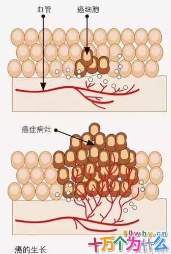癌症为什么可怕